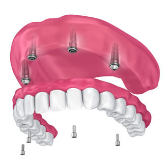 Structure of NU Teeth