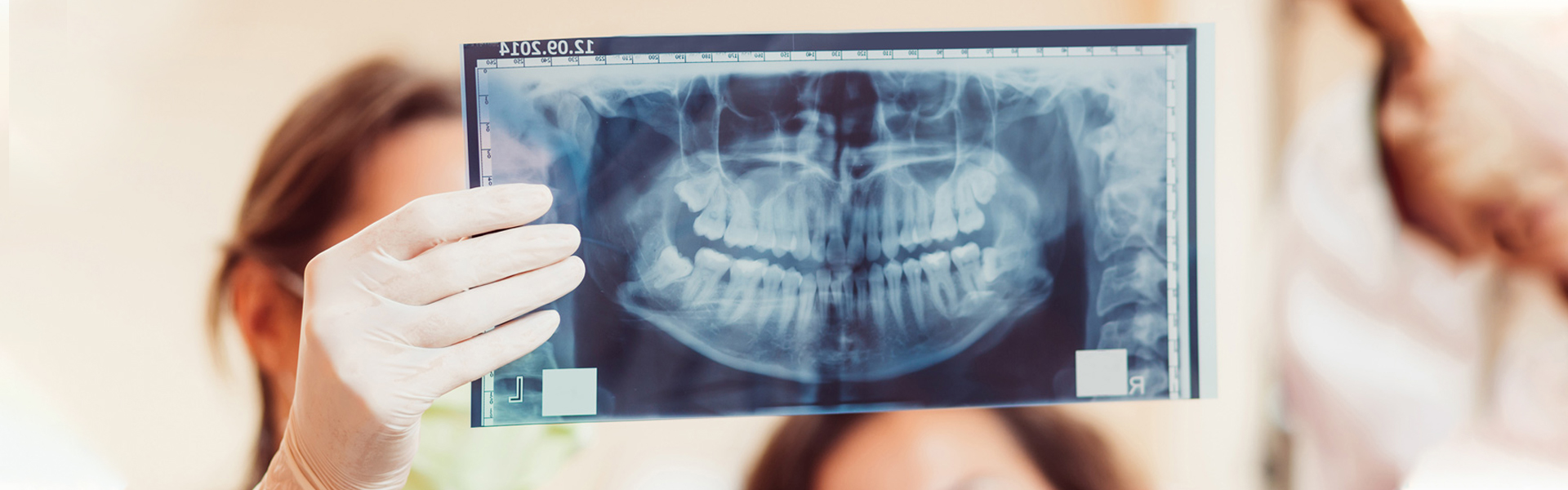 Why Is the CBCT Scan Better Than a Dental X-Ray?