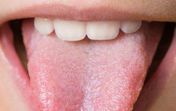 How Do I Know if My Baby Has a Tongue or Lip Tie?