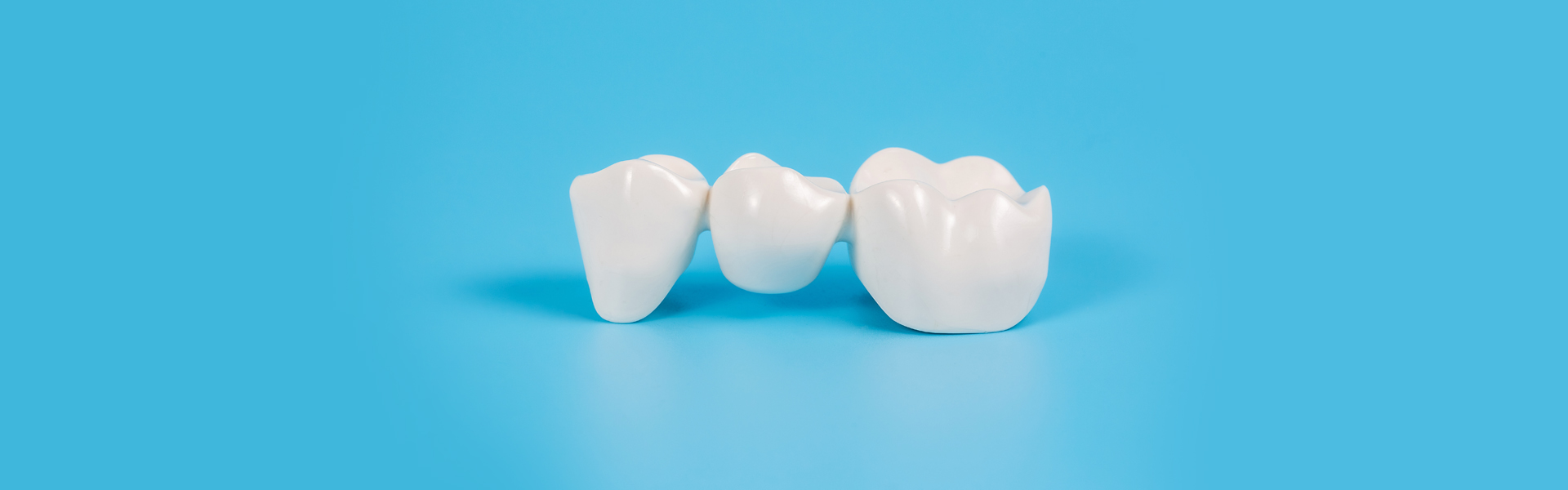 My Dental Bridge Cracked: What Should I Do?